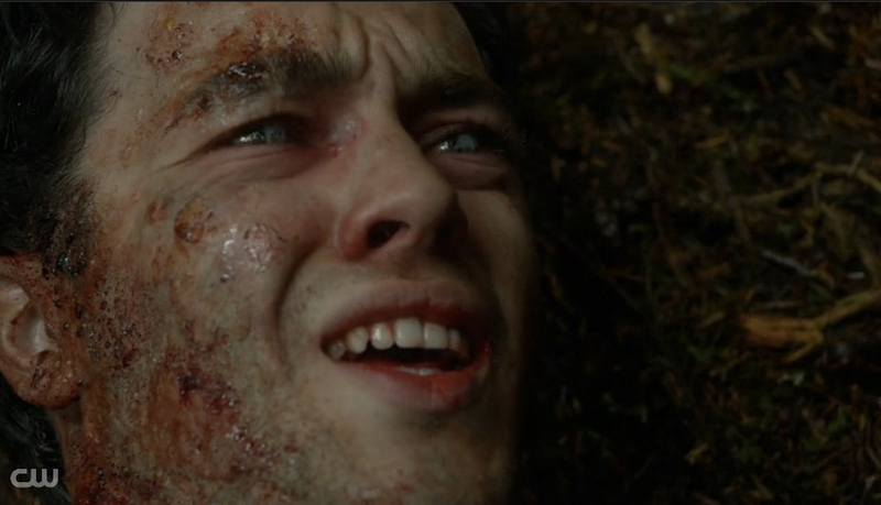 Illustration for article titled There Is So Much Death In The 100. So. Much. Death.